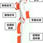 後弯