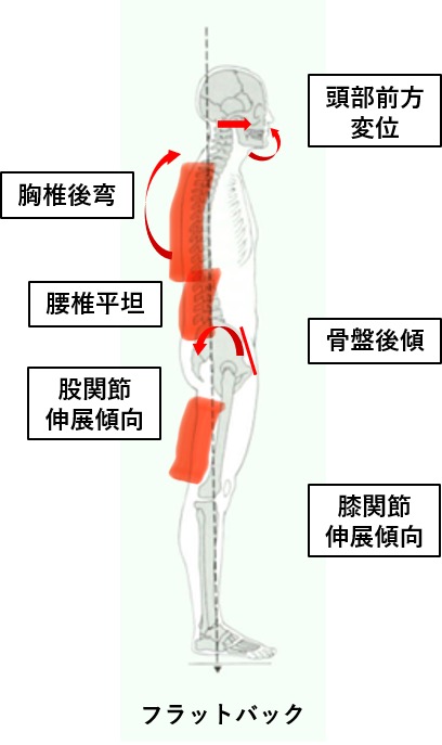 フラットバック
