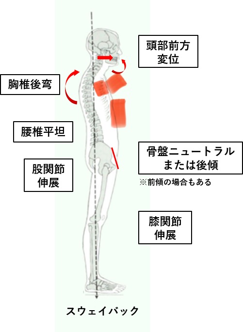 腰椎平坦。骨盤ニュートラル