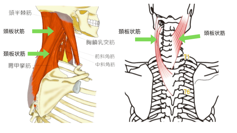 板状筋