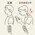 スマホネック姿勢